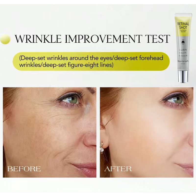 Retinal 0.1% Intensive Shot Pa - The Ordinary Serum Hyaluronic Acid ulasan dan harga