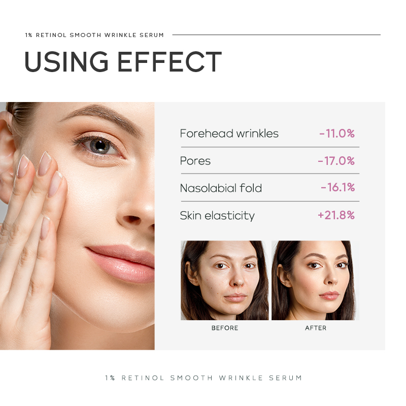 Quiyum 1% Retinol Smooth Wrink - The Ordinary Serum Hyaluronic Acid ulasan dan harga